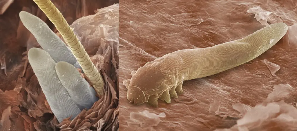 Demodex folliculorum